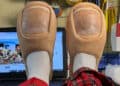 "Toe" Slippers Are The Rat Slides Of 2024