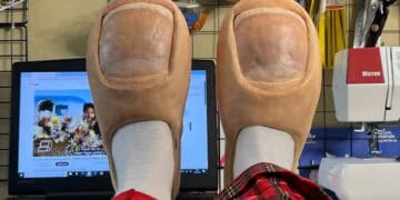 "Toe" Slippers Are The Rat Slides Of 2024